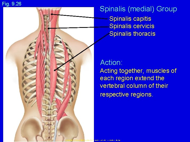 Fig. 9. 26 Spinalis (medial) Group Spinalis capitis Spinalis cervicis Spinalis thoracis Action: Acting