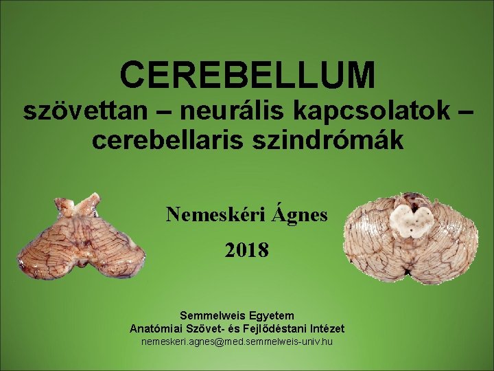 CEREBELLUM szövettan – neurális kapcsolatok – cerebellaris szindrómák Nemeskéri Ágnes 2018 Semmelweis Egyetem Anatómiai