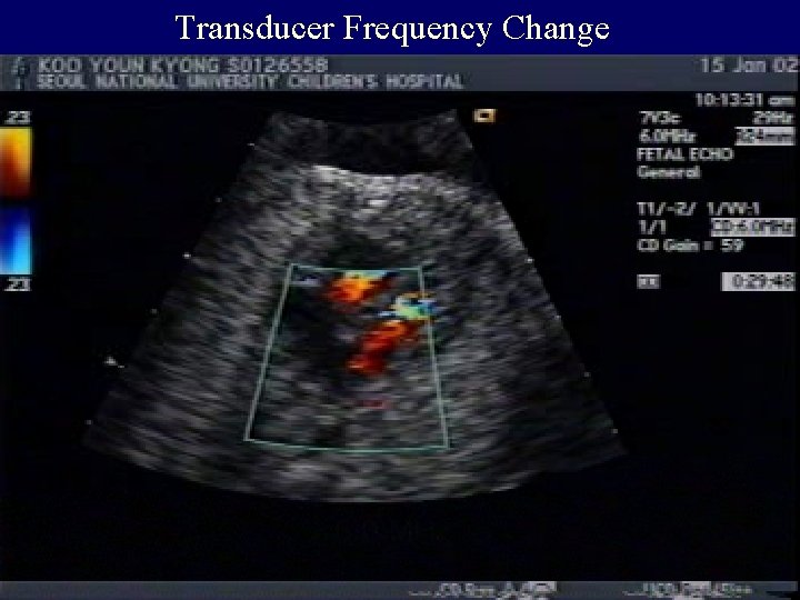 Transducer Frequency Change 