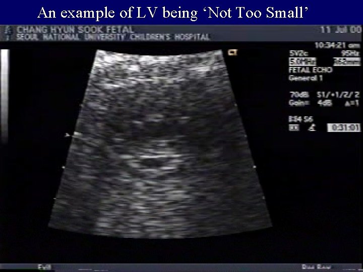 An example of LV being ‘Not Too Small’ 
