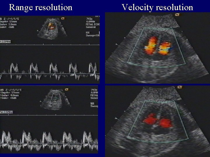 Range resolution Velocity resolution 