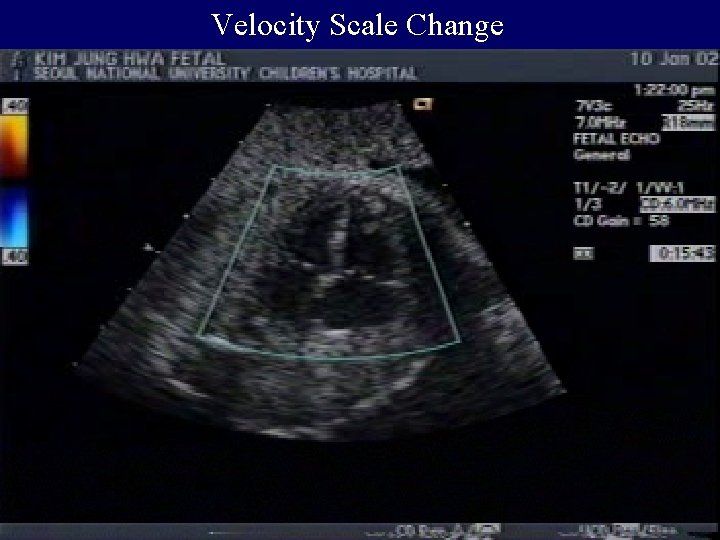 Velocity Scale Change 