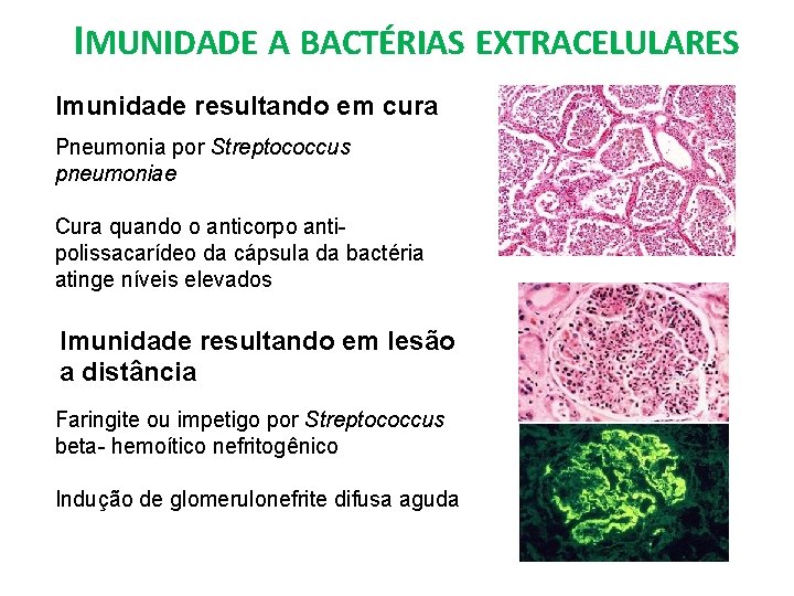 IMUNIDADE A BACTÉRIAS EXTRACELULARES Imunidade resultando em cura Pneumonia por Streptococcus pneumoniae Cura quando