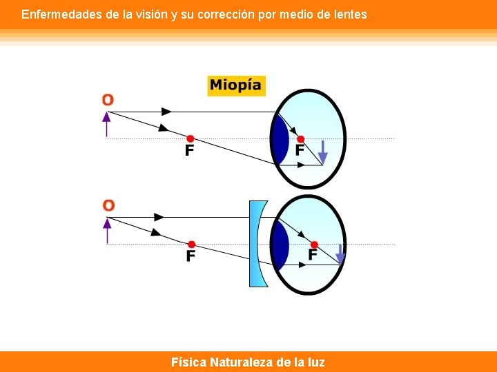 Enfermedades de la visión y su corrección por medio de lentes Física Naturaleza de