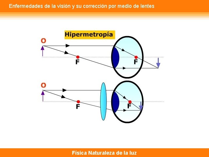 Enfermedades de la visión y su corrección por medio de lentes Física Naturaleza de