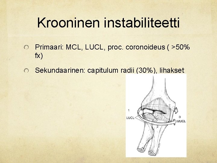 Krooninen instabiliteetti Primaari: MCL, LUCL, proc. coronoideus ( >50% fx) Sekundaarinen: capitulum radii (30%), Krooninen instabiliteetti Primaari: MCL, LUCL, proc. coronoideus ( >50% fx) Sekundaarinen: capitulum radii (30%),