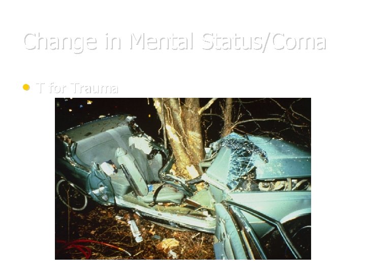 Change in Mental Status/Coma • T for Trauma 