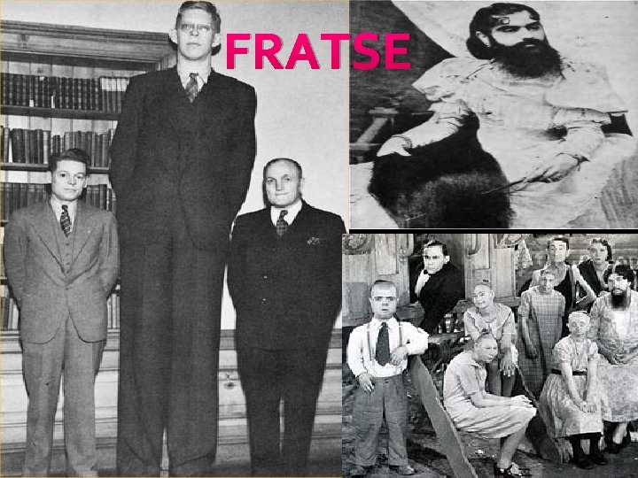 FRATSE 