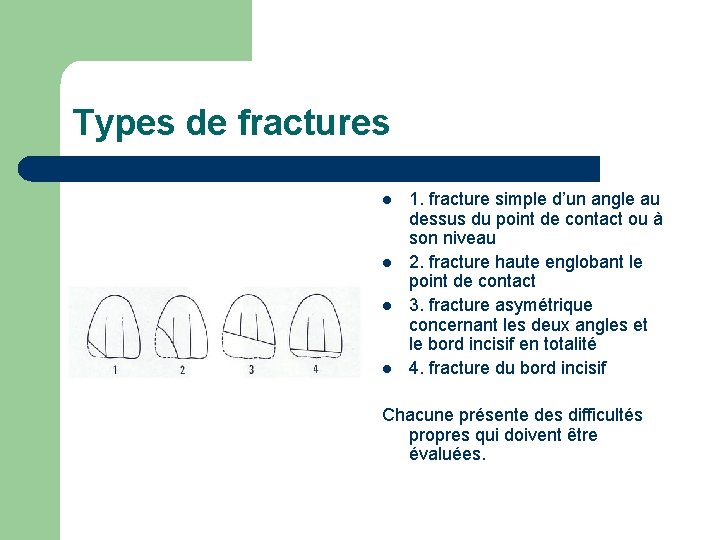 Types de fractures l l 1. fracture simple d’un angle au dessus du point Types de fractures l l 1. fracture simple d’un angle au dessus du point