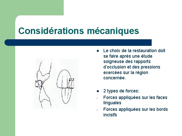 Considérations mécaniques l Le choix de la restauration doit se faire après une étude Considérations mécaniques l Le choix de la restauration doit se faire après une étude