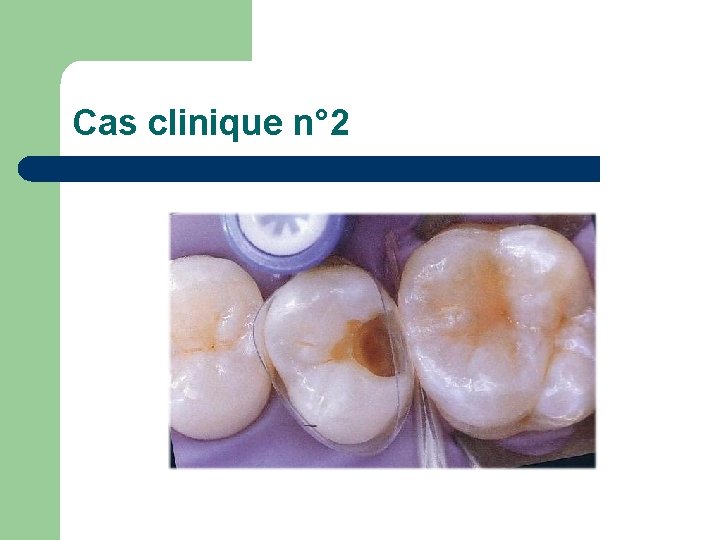 Cas clinique n° 2 Cas clinique n° 2