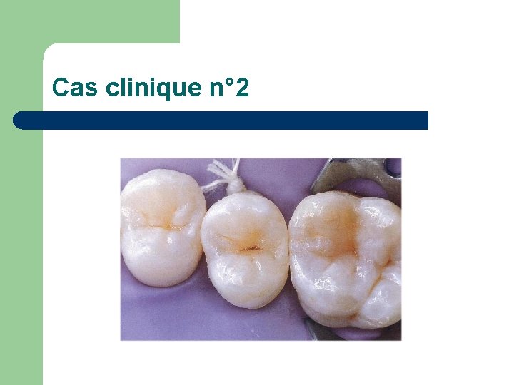 Cas clinique n° 2 Cas clinique n° 2