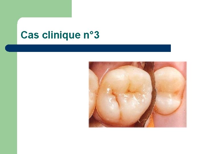 Cas clinique n° 3 Cas clinique n° 3