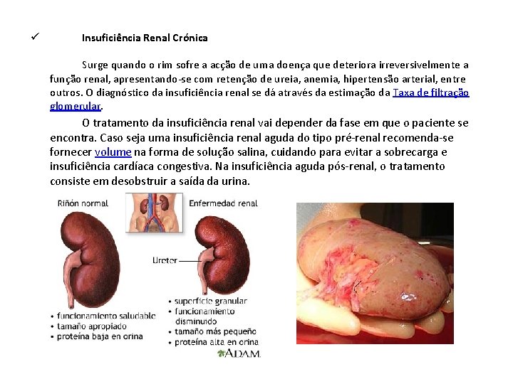 ü Insuficiência Renal Crónica Surge quando o rim sofre a acção de uma doença