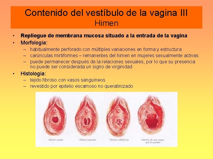 Contenido del vestíbulo de la vagina III Himen • • Repliegue de membrana mucosa