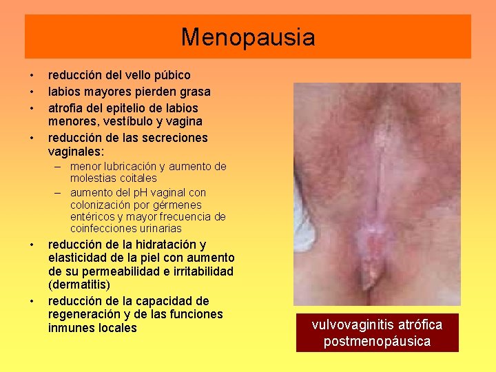 Menopausia • • reducción del vello púbico labios mayores pierden grasa atrofia del epitelio