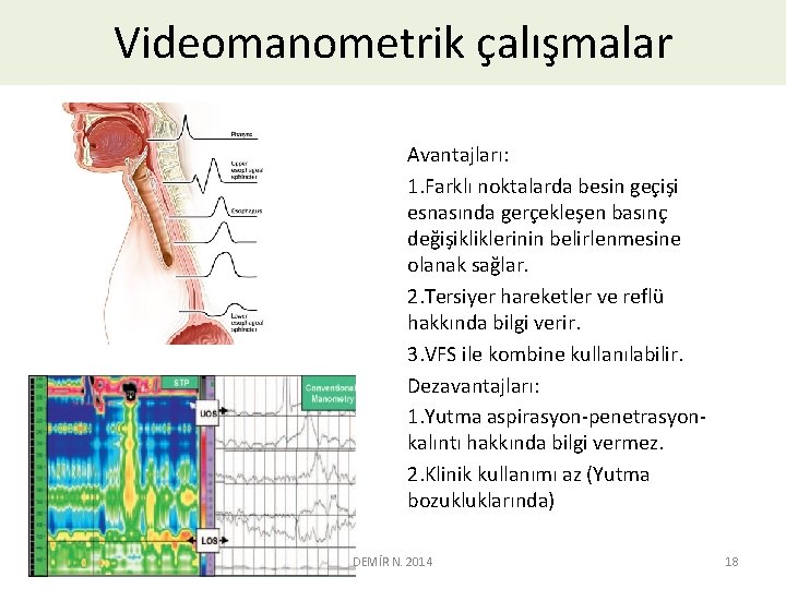 Videomanometrik çalışmalar Avantajları: 1. Farklı noktalarda besin geçişi esnasında gerçekleşen basınç değişikliklerinin belirlenmesine olanak