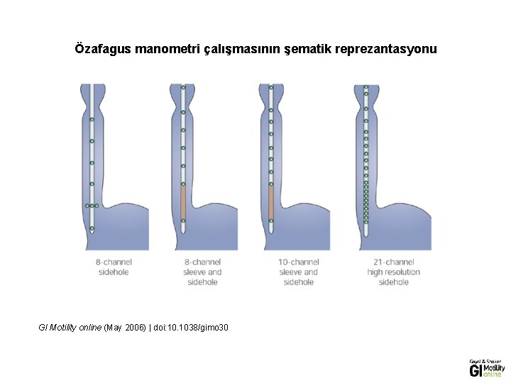 Özafagus manometri çalışmasının şematik reprezantasyonu GI Motility online (May 2006) | doi: 10. 1038/gimo