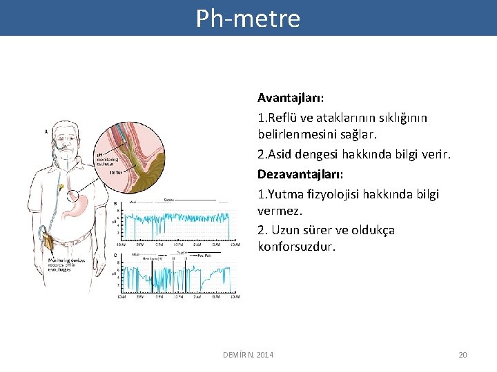 Ph-metre Avantajları: 1. Reflü ve ataklarının sıklığının belirlenmesini sağlar. 2. Asid dengesi hakkında bilgi