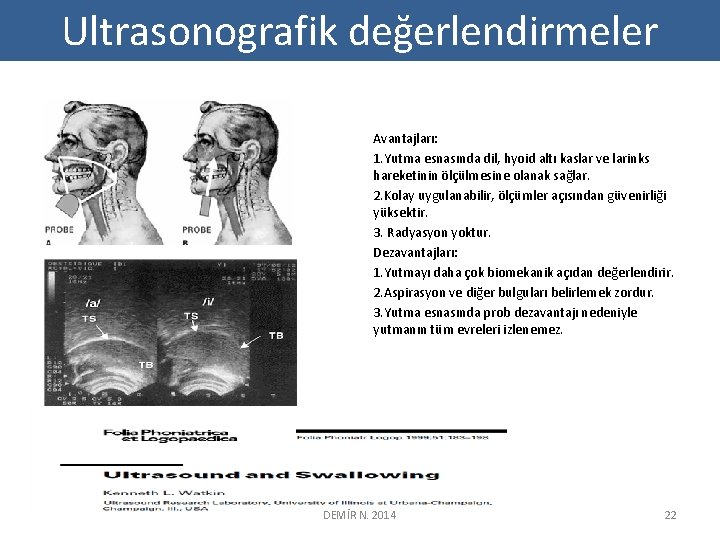 Ultrasonografik değerlendirmeler Avantajları: 1. Yutma esnasında dil, hyoid altı kaslar ve larinks hareketinin ölçülmesine