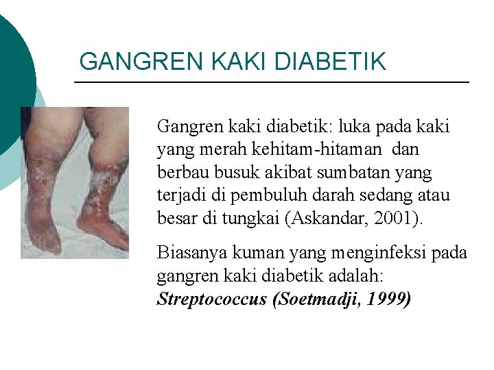 GANGREN KAKI DIABETIK Gangren kaki diabetik: luka pada kaki yang merah kehitam-hitaman dan berbau