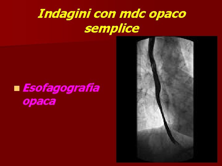 Indagini con mdc opaco semplice n Esofagografia opaca 