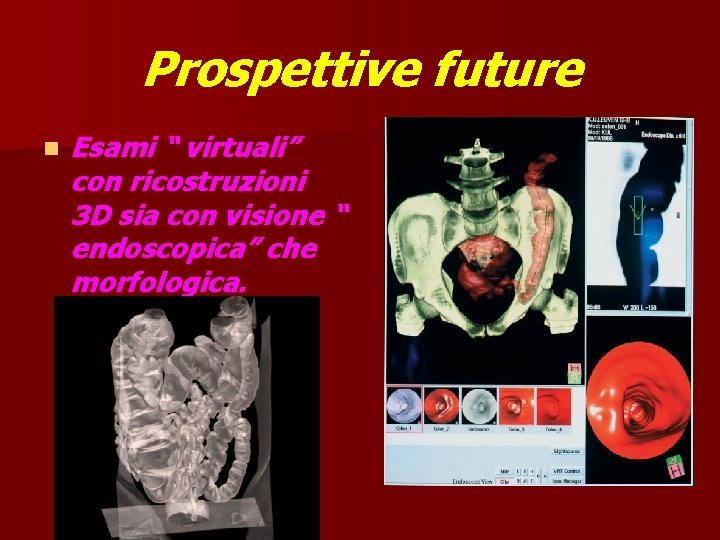 Prospettive future n Esami “ virtuali” con ricostruzioni 3 D sia con visione “