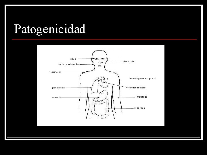 Patogenicidad 