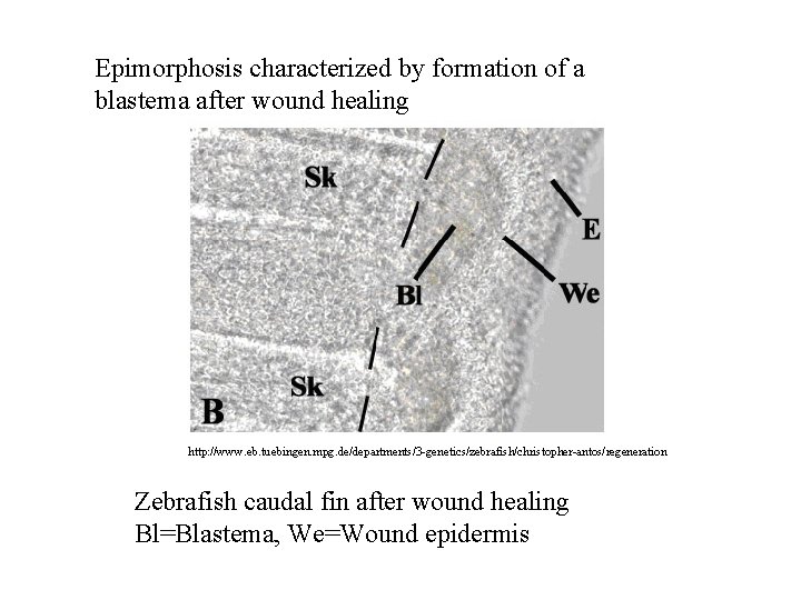 Epimorphosis characterized by formation of a blastema after wound healing http: //www. eb. tuebingen.