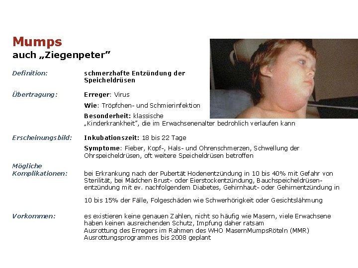 Mumps auch „Ziegenpeter” Definition: schmerzhafte Entzündung der Speicheldrüsen Übertragung: Erreger: Virus Wie: Tröpfchen- und