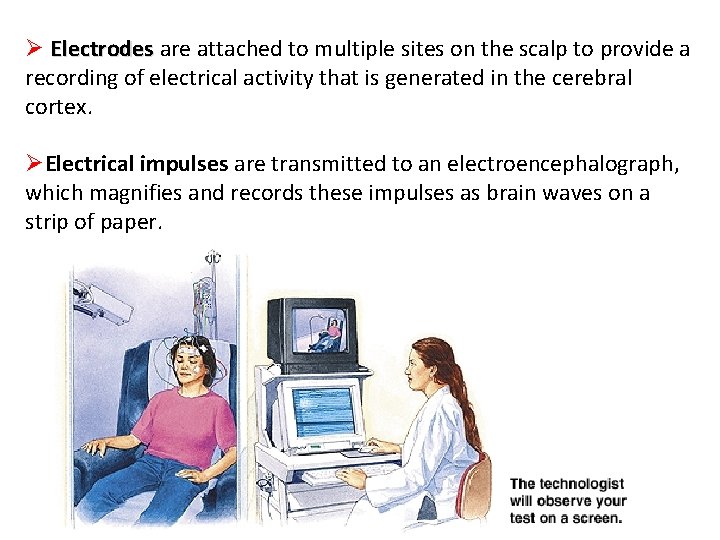 Ø Electrodes are attached to multiple sites on the scalp to provide a Electrodes