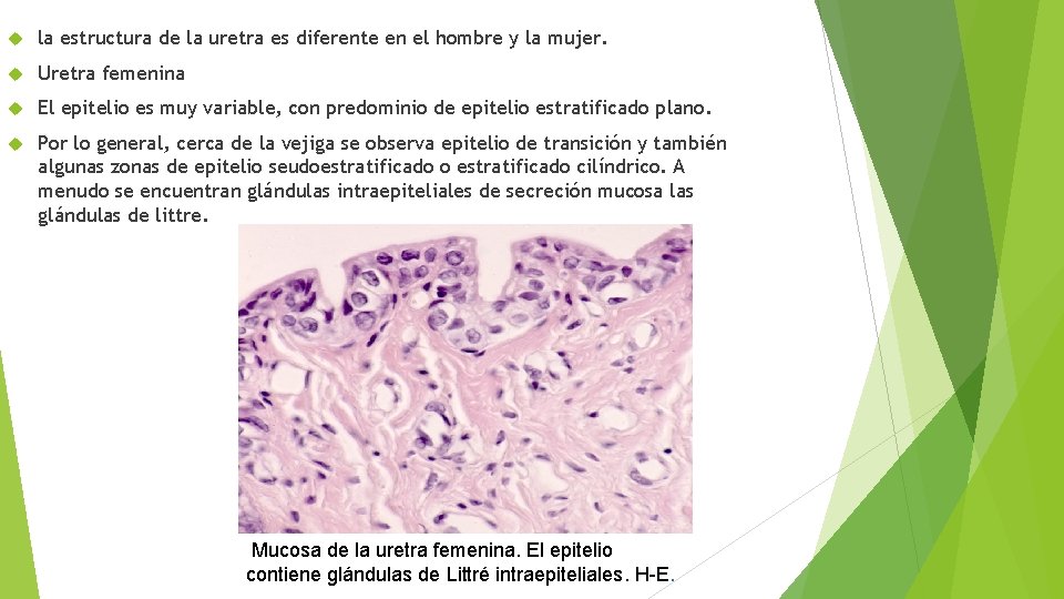  la estructura de la uretra es diferente en el hombre y la mujer.