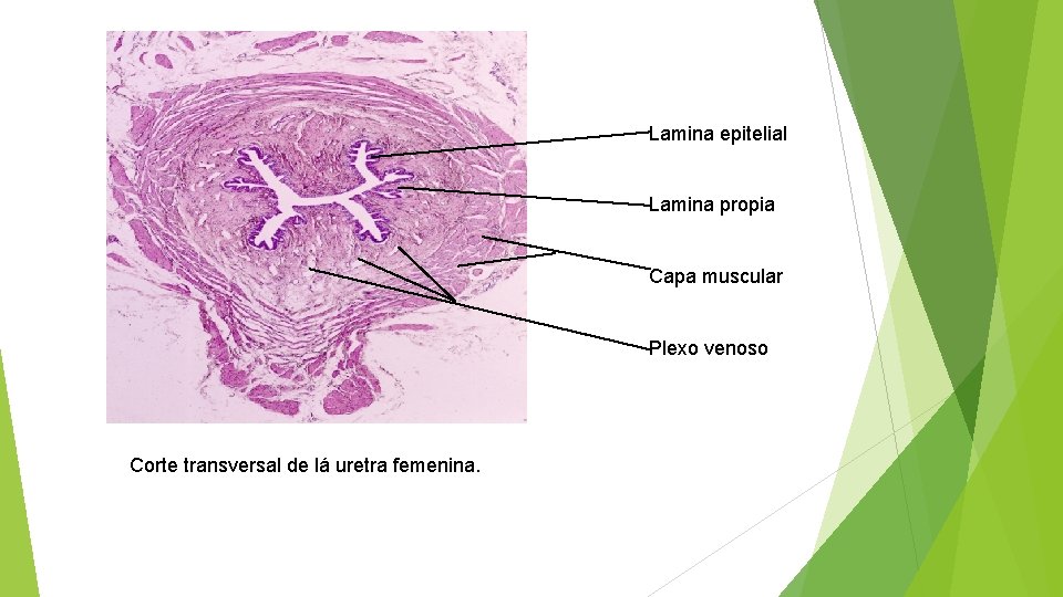 Lamina epitelial Lamina propia Capa muscular Plexo venoso Corte transversal de lá uretra femenina.
