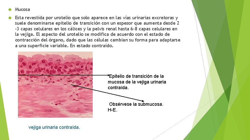  Mucosa Esta revestida por urotelio que solo aparece en las vías urinarias excretoras