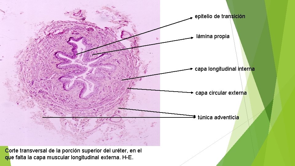 epitelio de transición lámina propia capa longitudinal interna capa circular externa túnica adventicia Corte