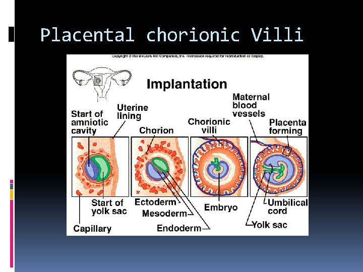 Placental chorionic Villi 