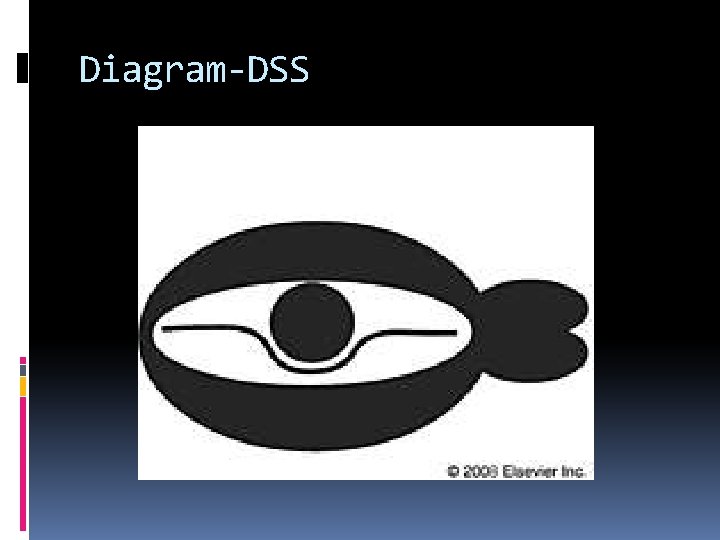 Diagram-DSS 