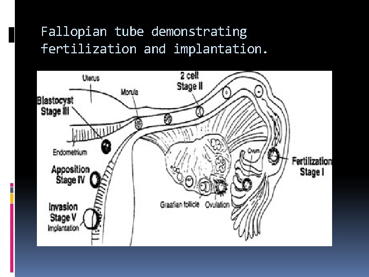 Fallopian tube demonstrating fertilization and implantation. 