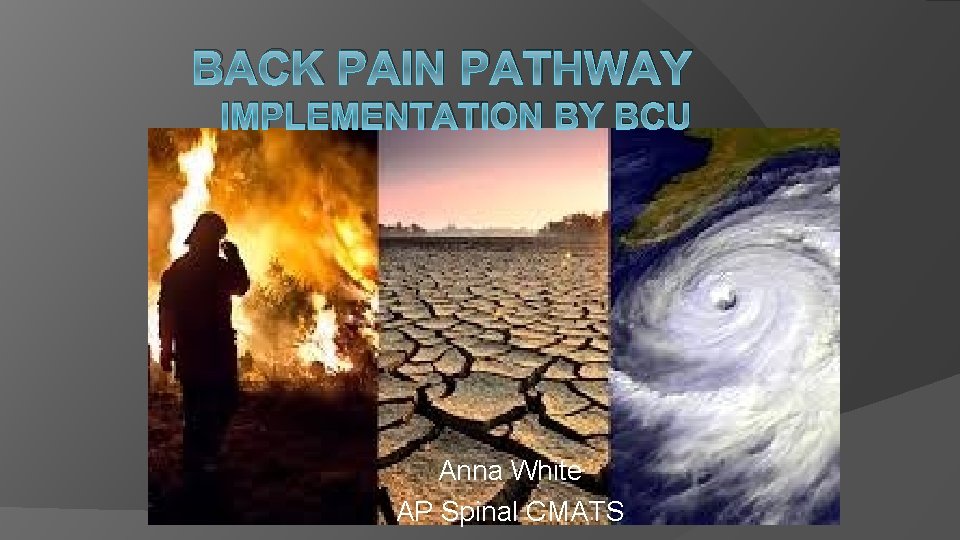 BACK PAIN PATHWAY IMPLEMENTATION BY BCU Anna White AP Spinal CMATS BACK PAIN PATHWAY IMPLEMENTATION BY BCU Anna White AP Spinal CMATS