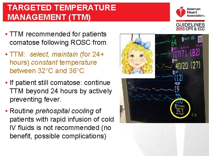 TARGETED TEMPERATURE MANAGEMENT (TTM) • TTM recommended for patients comatose following ROSC from •