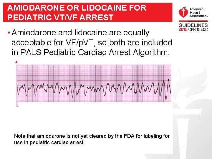 AMIODARONE OR LIDOCAINE FOR PEDIATRIC VT/VF ARREST • Amiodarone and lidocaine are equally acceptable