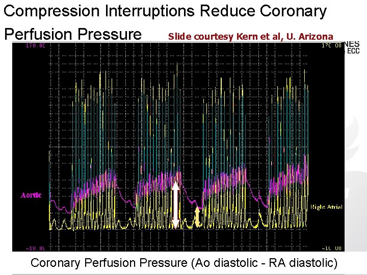 Compression Interruptions Reduce Coronary Slide courtesy Kern et al, U. Arizona Perfusion Pressure Coronary