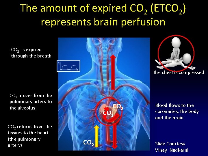 The amount of expired CO 2 (ETCO 2) represents brain perfusion CO 2 is