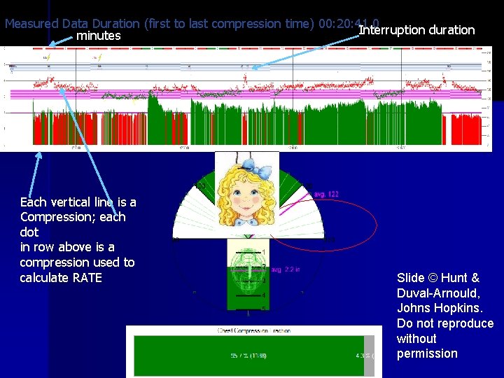 Measured Data Duration (first to last compression time) 00: 20: 41. 0 Interruption duration