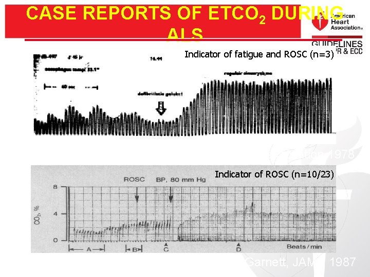 CASE REPORTS OF ETCO 2 DURING ALS Indicator of fatigue and ROSC (n=3) Kalenda,