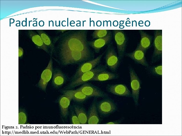 Padrão nuclear homogêneo Figura 2. Padrão por imunofluorescência http: //medlib. med. utah. edu/Web. Path/GENERAL. Padrão nuclear homogêneo Figura 2. Padrão por imunofluorescência http: //medlib. med. utah. edu/Web. Path/GENERAL.