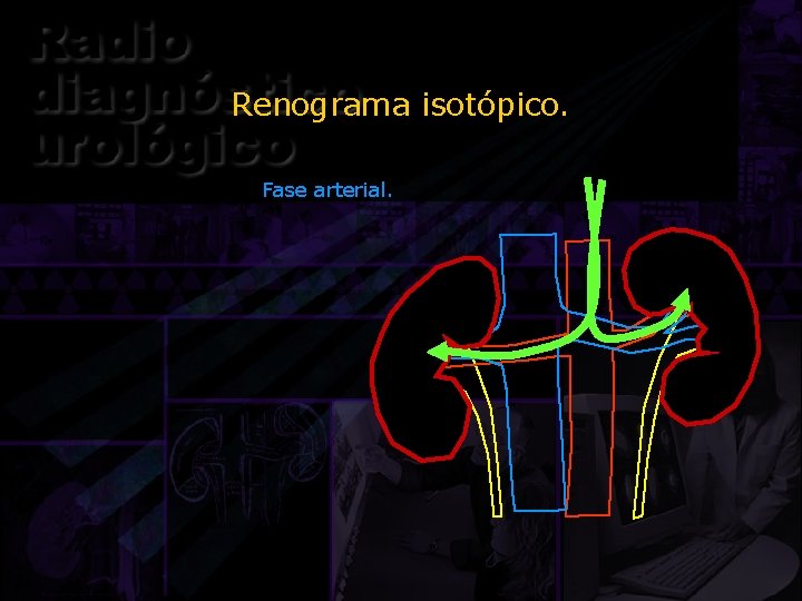 Renograma isotópico. Fase arterial. 