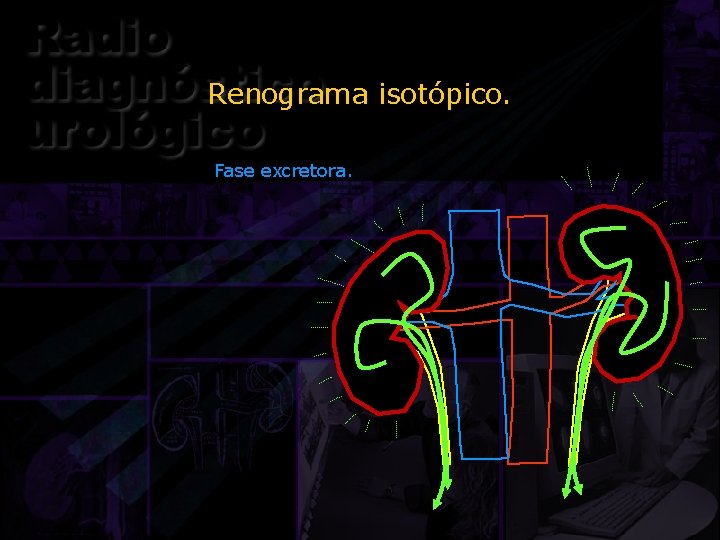 Renograma isotópico. Fase excretora. 