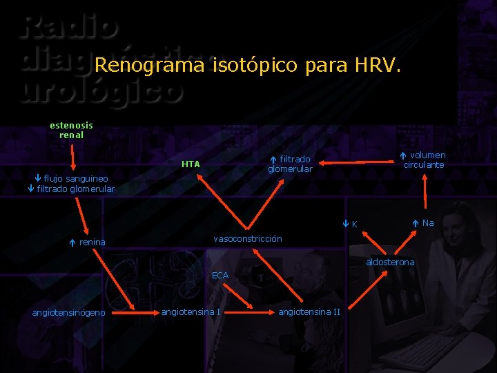 Renograma isotópico para HRV. estenosis renal volumen circulante filtrado glomerular HTA flujo sanguíneo filtrado