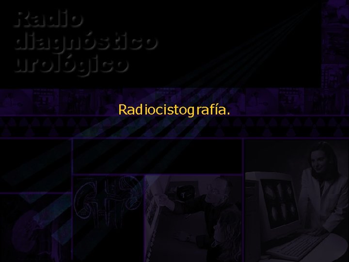 Radiocistografía. 